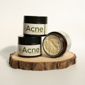CBD Acne Cream
